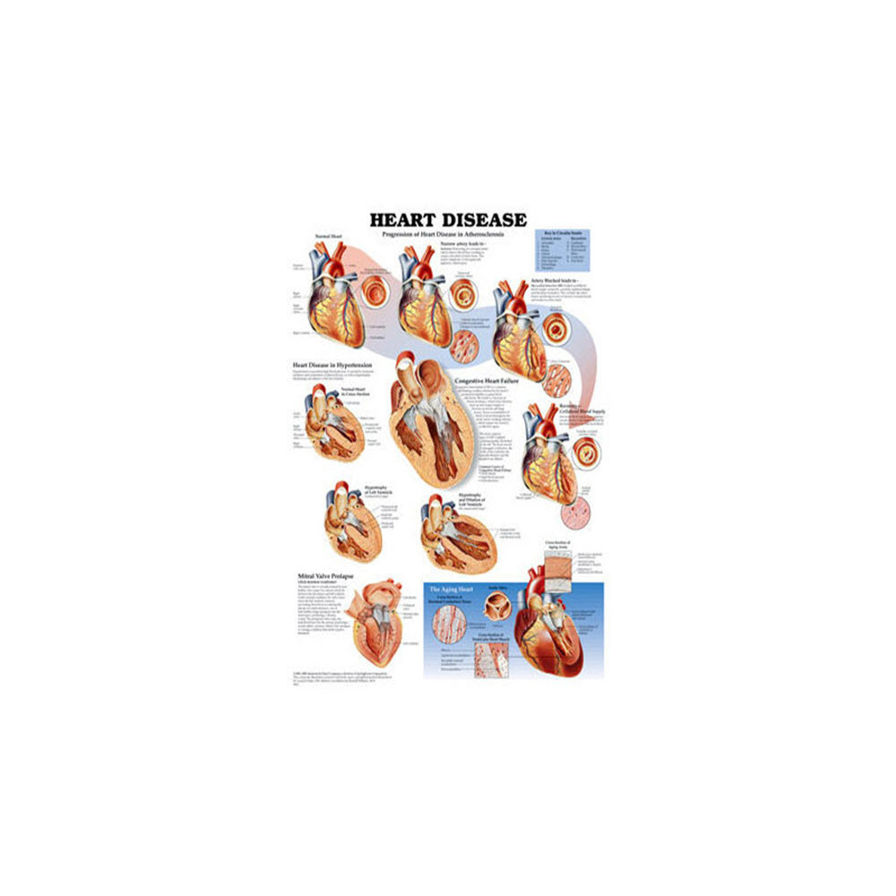 Heart Disease Poster Alpha First Aid Heart Disease Poster Alpha First Aid